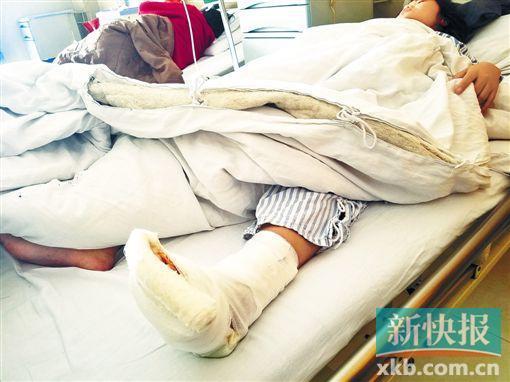 ■覃小姐左脚背被玻璃碎块砸伤,导致肌腱断裂。新快报记者彭程/摄